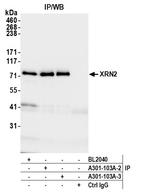 XRN2 Antibody in Immunoprecipitation (IP)