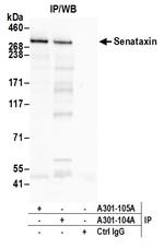 Senataxin Antibody in Immunoprecipitation (IP)