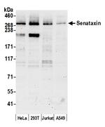 Senataxin Polyclonal Antibody