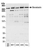 Senataxin Polyclonal Antibody