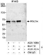 PDCD4 Antibody in Immunoprecipitation (IP)