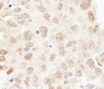 Cul3 Polyclonal Antibody