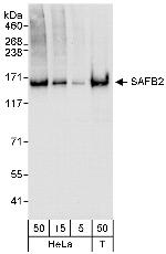 SAFB2 Polyclonal Antibody