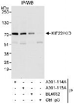 KIF22/KID Polyclonal Antibody