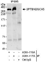 SPTBN2/SCA5 Polyclonal Antibody