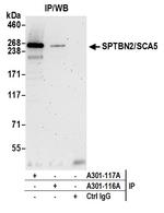 SPTBN2/SCA5 Antibody in Immunoprecipitation (IP)