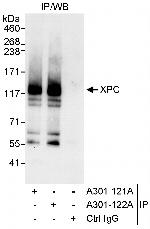 XPC Polyclonal Antibody