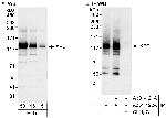 XPC Polyclonal Antibody