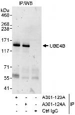 UBE4B Antibody in Immunoprecipitation (IP)