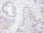 UBE1 Polyclonal Antibody