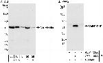 Calreticulin Polyclonal Antibody