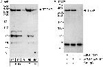 TRRAP Polyclonal Antibody