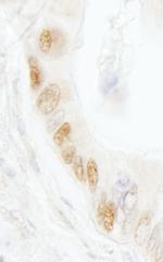 DNA Ligase 1 Polyclonal Antibody