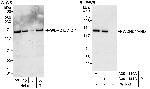 WDHD1/AND-1 Antibody in Western Blot (WB)