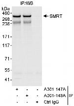 SMRT Antibody in Immunoprecipitation (IP)