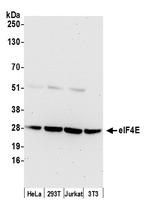 eIF4E Polyclonal Antibody