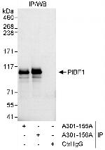 PIBF Polyclonal Antibody