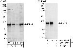 PIBF Polyclonal Antibody