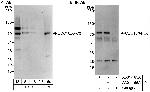 CDC16/APC6 Polyclonal Antibody