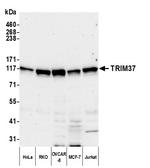 TRIM37 Polyclonal Antibody