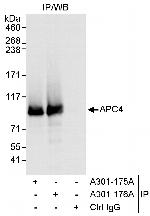 APC4 Antibody in Immunoprecipitation (IP)