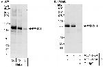 FBXO11 Polyclonal Antibody