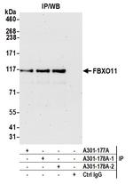 FBXO11 Antibody in Immunoprecipitation (IP)