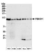 FBXO11 Polyclonal Antibody