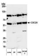 CDC20 Polyclonal Antibody