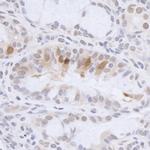 HMGN3 Antibody in Immunohistochemistry (Paraffin) (IHC (P))