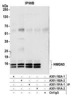 HMGN3 Antibody in Immunoprecipitation (IP)