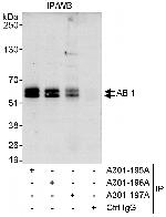 ABI1 Polyclonal Antibody