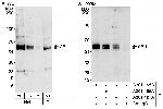 ABI1 Antibody in Western Blot (WB)