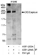CIC/Capicua Antibody in Immunoprecipitation (IP)
