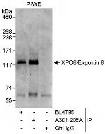 XPO6/Exportin 6 Polyclonal Antibody