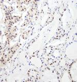 RBM26 Polyclonal Antibody