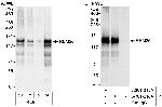 RBM26 Antibody in Western Blot (WB)