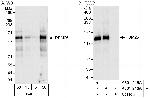 RBM26 Polyclonal Antibody