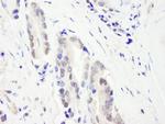 CHD3 Polyclonal Antibody