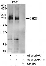 CHD3 Antibody in Immunoprecipitation (IP)