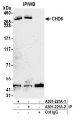 CHD6 Antibody in Immunoprecipitation (IP)