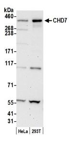 CHD7 Polyclonal Antibody