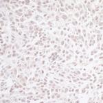 CHD8 Polyclonal Antibody