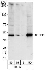TBP Polyclonal Antibody