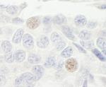 GTF3C2/TFIIIC110 Antibody in Immunohistochemistry (Paraffin) (IHC (P))
