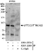 GTF3C3/TFIIIC102 Polyclonal Antibody