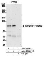 GTF3C3/TFIIIC102 Antibody in Immunoprecipitation (IP)