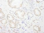 GTF3C4/TFIIIC90 Polyclonal Antibody
