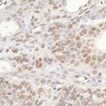 GTF3C5/TFIIIC63 Antibody in Immunohistochemistry (Paraffin) (IHC (P))