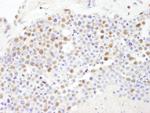 PolD3/p66 Polyclonal Antibody